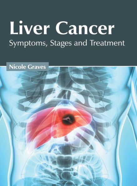 Liver Cancer: Symptoms, Stages and Treatment