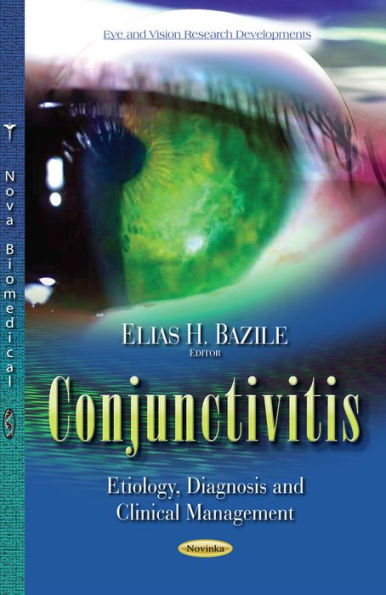 Conjunctivitis: Etiology, Diagnosis and Clinical Management