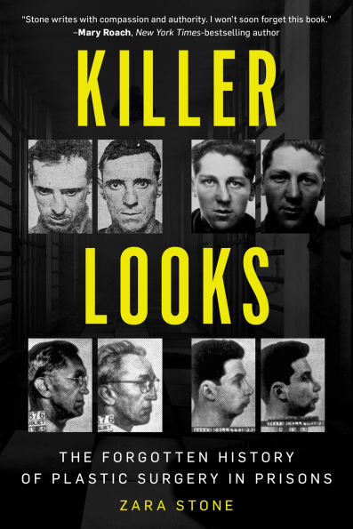 Killer Looks: The Forgotten History of Plastic Surgery Prisons