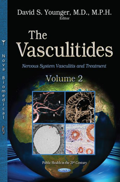 The Vasculitides, Volume 2: Nervous System Vasculitis and Treatment