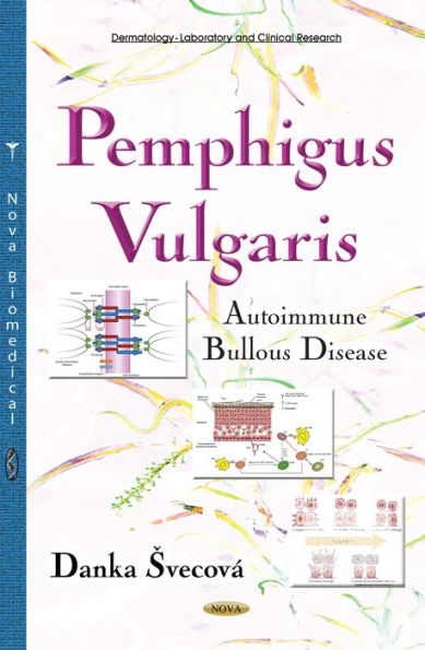 Pemphigus Vulgaris: Autoimmune Bullous Disease