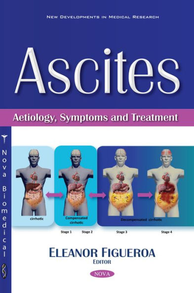 Ascites: Aetiology, Symptoms and Treatment