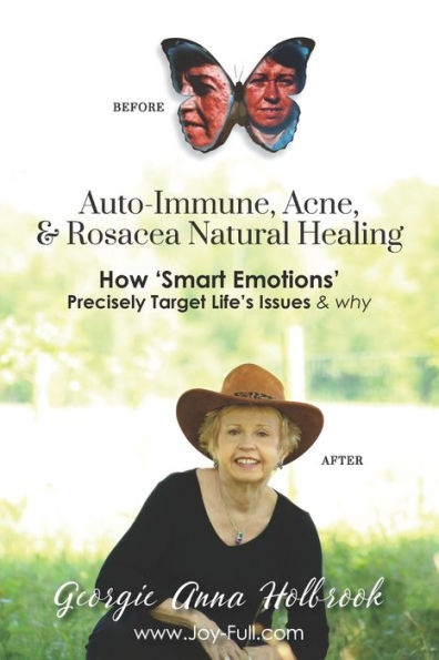 Auto-Immune, Acne, & Rosacea Natural Healing - How 'Smart Emotions' Precisely Target Life's Issues Why