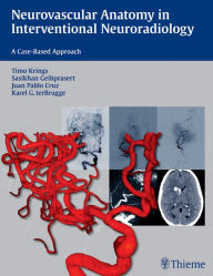 Title: Neurovascular Anatomy in Interventional Neuroradiology: A Case-Based Approach, Author: Timo Krings