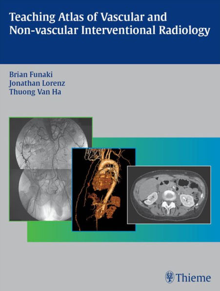 Teaching Atlas of Vascular and Non-vascular Interventional Radiology
