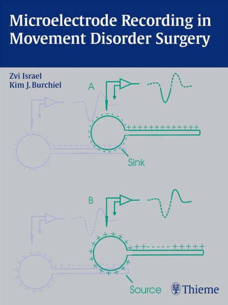 Microelectrode Recording in Movement Disorder Surgery