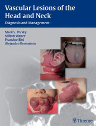 Title: Vascular Lesions of the Head and Neck: Diagnosis and Management, Author: Mark S. Persky
