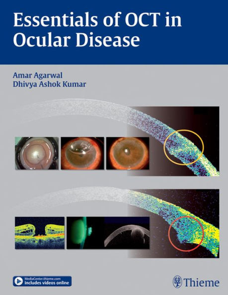 Essentials of OCT in Ocular Disease