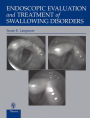 Endoscopic Evaluation and Treatment of Swallowing Disorders