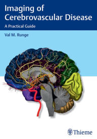 Title: Imaging of Cerebrovascular Disease: A Practical Guide, Author: Val M. Runge