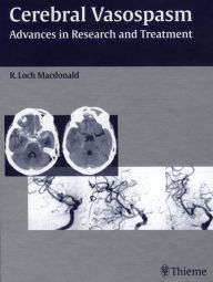 Title: Cerebral Vasospasm: Advances in Research and Treatment, Author: R. Loch Macdonald