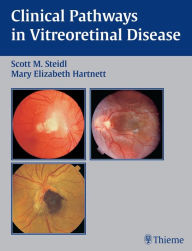 Title: Clinical Pathways In Vitreoretinal Disease, Author: Scott M. Steidl