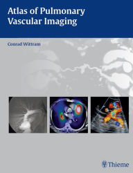 Title: Atlas of Pulmonary Vascular Imaging, Author: Conrad Wittram