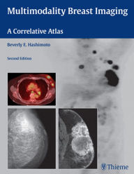 Title: Multimodality Breast Imaging: A Correlative Atlas, Author: Beverly Hashimoto