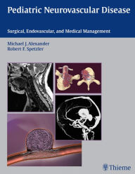 Title: Pediatric Neurovascular Disease: Surgical, Endovascular, and Medical Management, Author: Michael J. Alexander