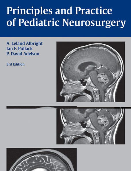 Principles and Practice of Pediatric Neurosurgery