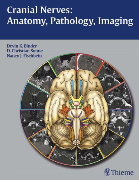 Cranial Nerves: Anatomy, Pathology, Imaging