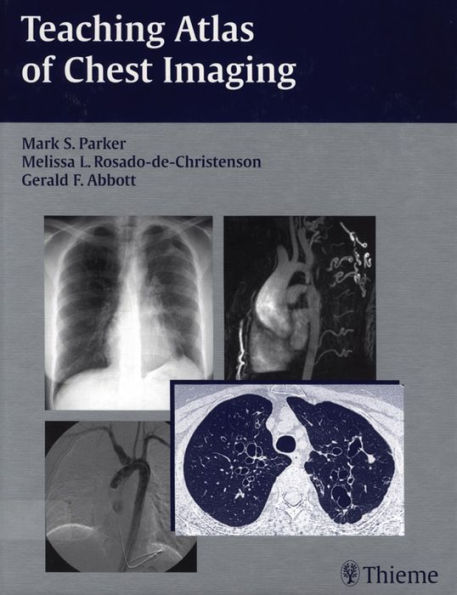 Teaching Atlas of Chest Imaging