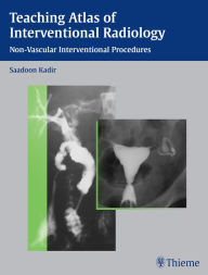 Title: Teaching Atlas of Interventional Radiology: Non-Vascular Interventional Procedures, Author: Saadoon Kadir