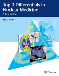 Title: Top 3 Differentials in Nuclear Medicine: A Case Review, Author: Ely A. Wolin