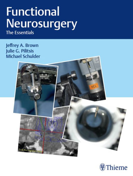 Functional Neurosurgery: The Essentials