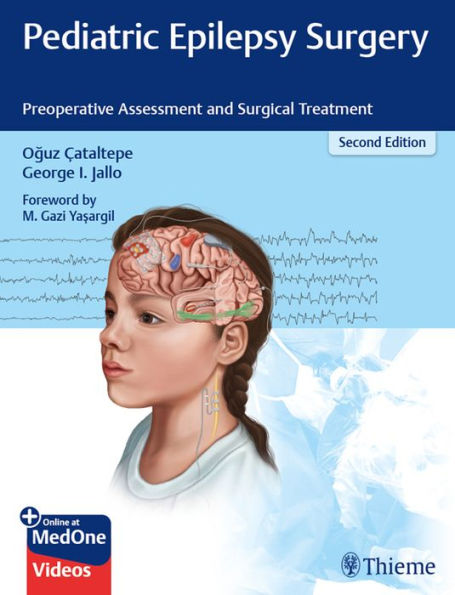 Pediatric Epilepsy Surgery: Preoperative Assessment and Surgical Treatment