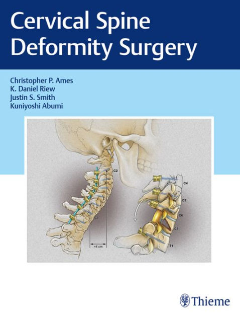 Cervical Spine Deformity Surgery by Christopher P. Ames, K. Daniel Riew ...