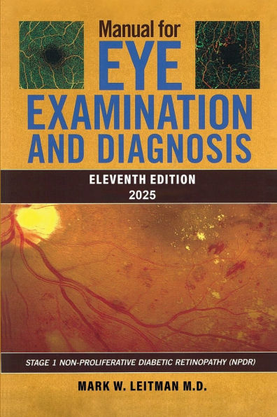 Manual for Eye Examination and Diagnosis (Eleventh Edition 2025): Stage 1 Non- Proliferative Diabetic Retinopathy (NPDR)