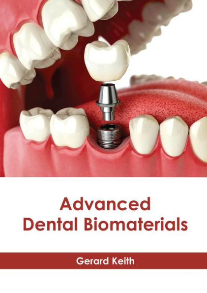 Advanced Dental Biomaterials