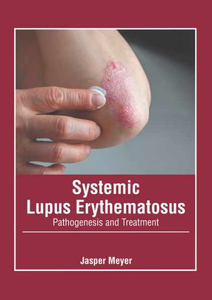 Systemic Lupus Erythematosus: Pathogenesis and Treatment