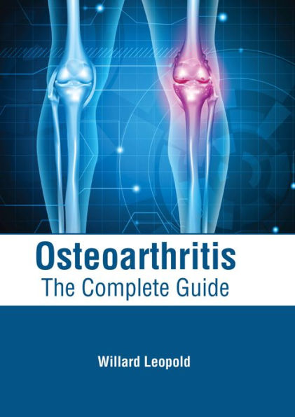 Osteoarthritis: The Complete Guide