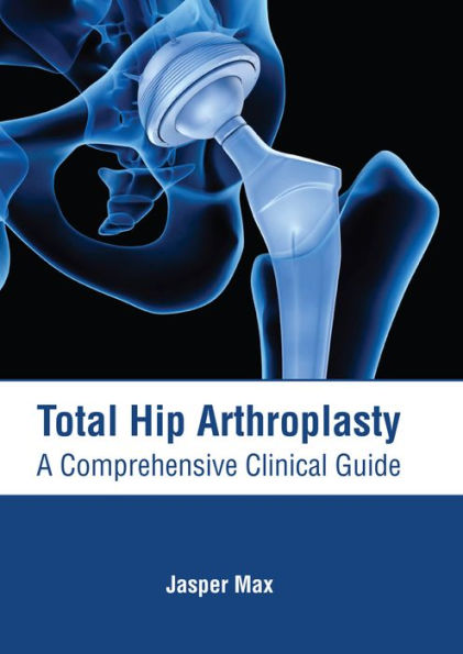 Total Hip Arthroplasty: A Comprehensive Clinical Guide