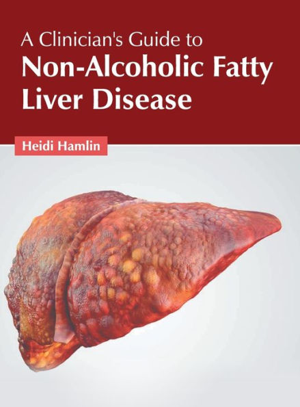 A Clinician's Guide to Non-Alcoholic Fatty Liver Disease