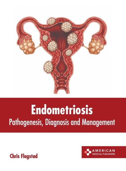 Endometriosis: Pathogenesis, Diagnosis and Management