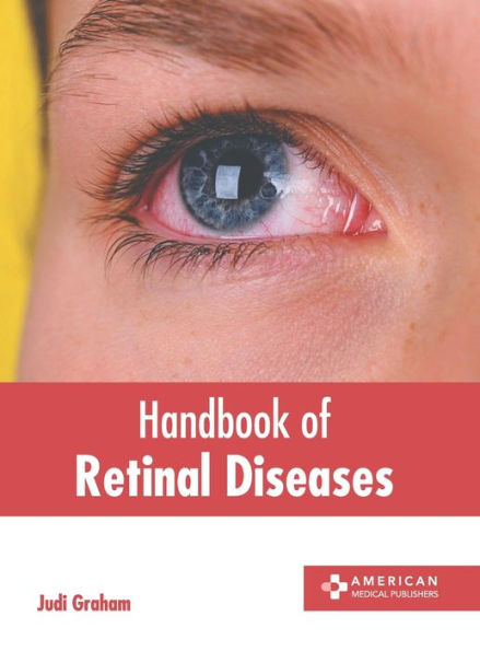 Handbook of Retinal Diseases