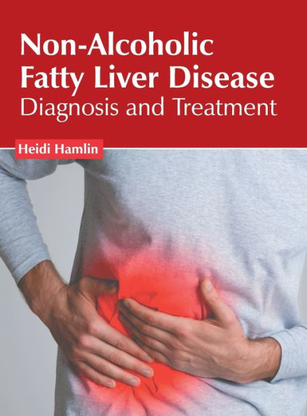 Non-Alcoholic Fatty Liver Disease: Diagnosis and Treatment