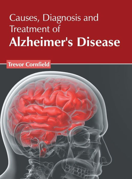 Causes, Diagnosis and Treatment of Alzheimer's Disease