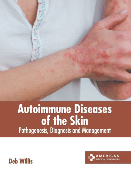 Autoimmune Diseases of the Skin: Pathogenesis, Diagnosis and Management