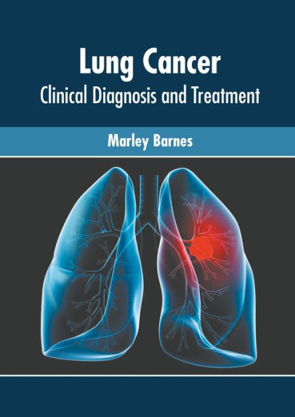 Lung Cancer: Clinical Diagnosis and Treatment