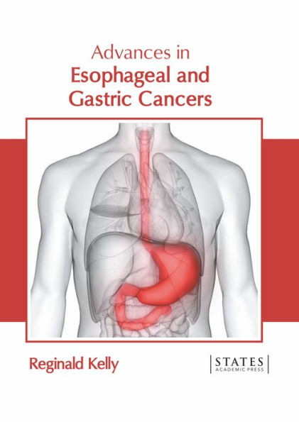 Advances in Esophageal and Gastric Cancers