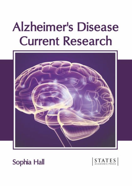 Alzheimer's Disease: Current Research