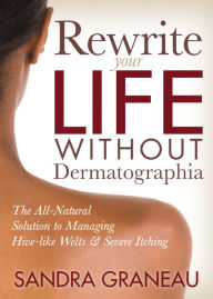 Title: Rewrite Your Life Without Dermatographia: The All-Natural Solution to Managing Hive-like Welts & Severe Itching, Author: Sandra Graneau