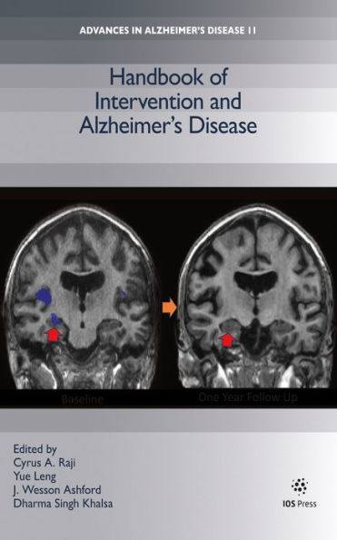 Handbook of Intervention and Alzheimer's Disease