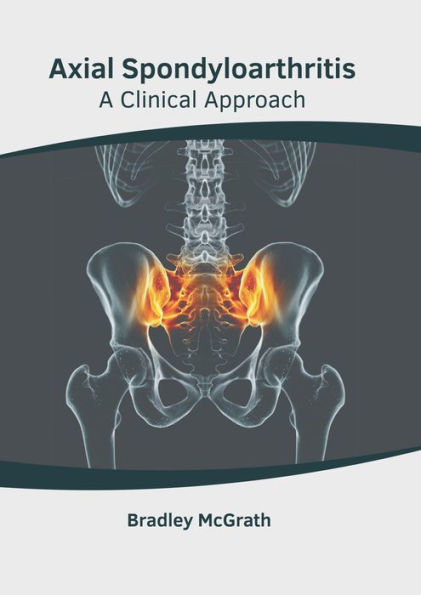 Axial Spondyloarthritis: A Clinical Approach