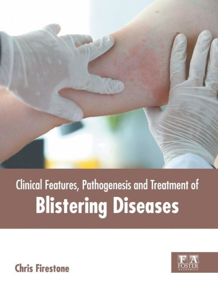 Clinical Features, Pathogenesis and Treatment of Blistering Diseases