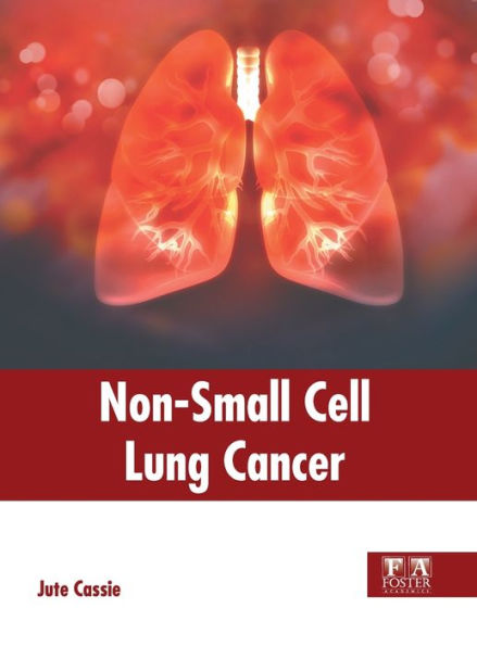 Non-Small Cell Lung Cancer