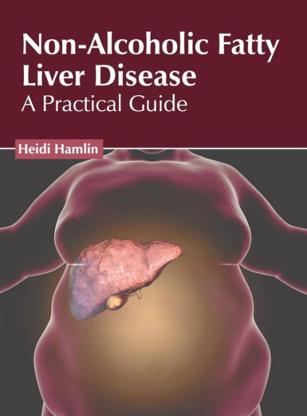 Non-Alcoholic Fatty Liver Disease: A Practical Guide