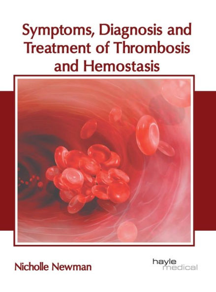 Symptoms, Diagnosis and Treatment of Thrombosis and Hemostasis