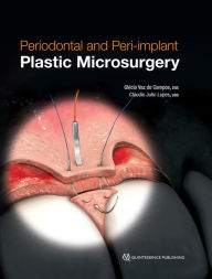 Title: Periodontal and Peri-implant Plastic Microsurgery: Minimally Invasive Techniques with Maximum Precision, Author: Glécio Vaz de Campos