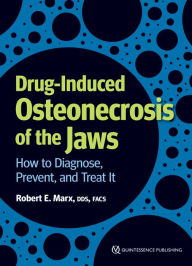 Title: Drug-Induced Osteonecrosis of the Jaws: How to Diagnose, Prevent, and Treat It, Author: Robert E. Marx